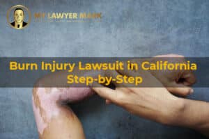 Burn Injury Lawsuit