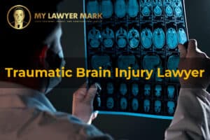 california traumatic brain injury lawyer