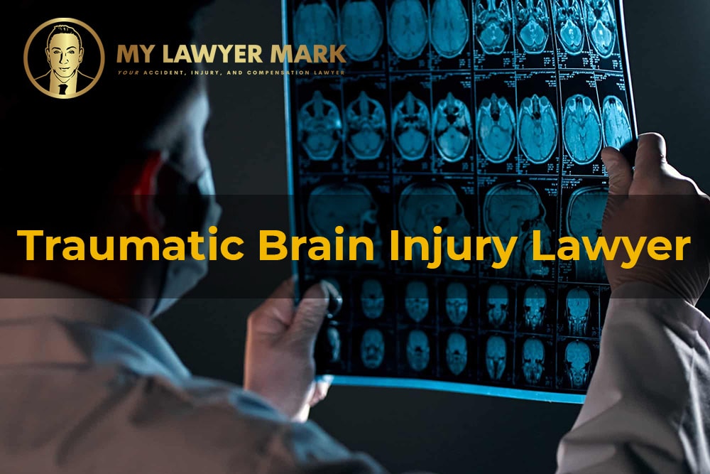 Traumatic Brain Injury Lawyers | Accident Attorneys in Los Angeles
