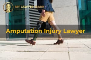 amputation injury attorney